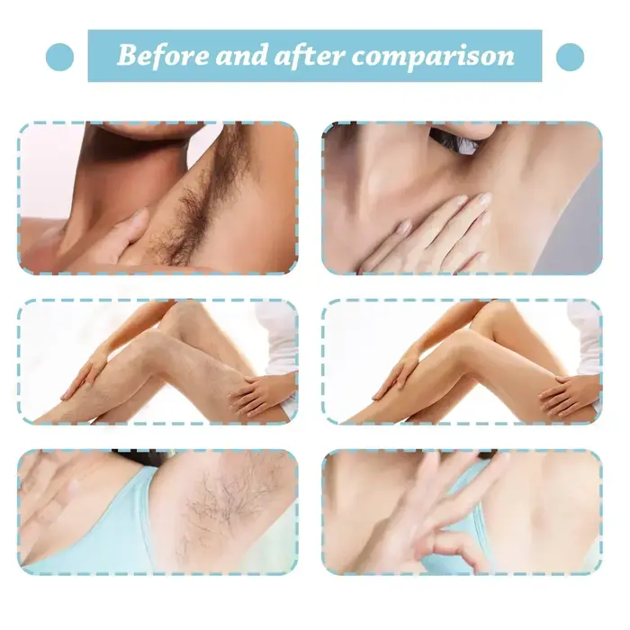 Sérum d'inhibition des cheveux en continu