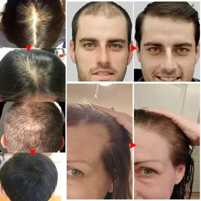 Spray de croissance rapide des cheveux à la biotine