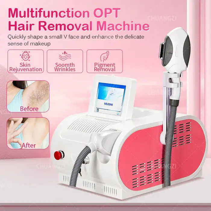 Appareil d'épilation permanente indolore IPL E-Light OPT Laser 500 000 impulsions pour éliminer les taches pigmentaires, les rougeurs et l'acné, rajeunissement par photons