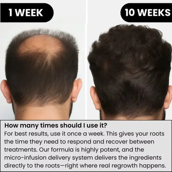 Sérum capillaire doux nourrit le cuir chevelu et soin pour les cheveux adoucissants Soins quotidiens