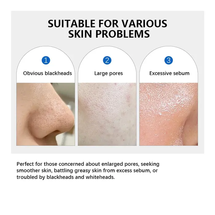 Coussinet pour pores zéro 2.0
