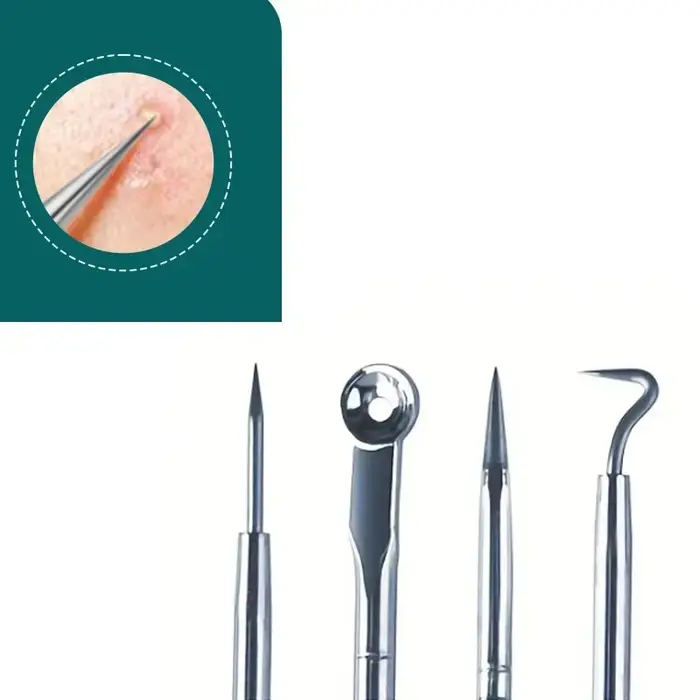Pince à épiler ultra-fine pour points noirs et boutons