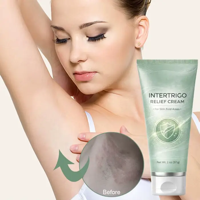 Crème apaisante pour l'abrasion cutanée, Lotion non grasse, crème pour les aisselles, pour femmes et hommes, réduction de la friction, hydratante, 57g, 1 pièce