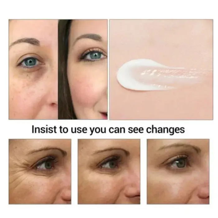 Crème pour les yeux anti-poches