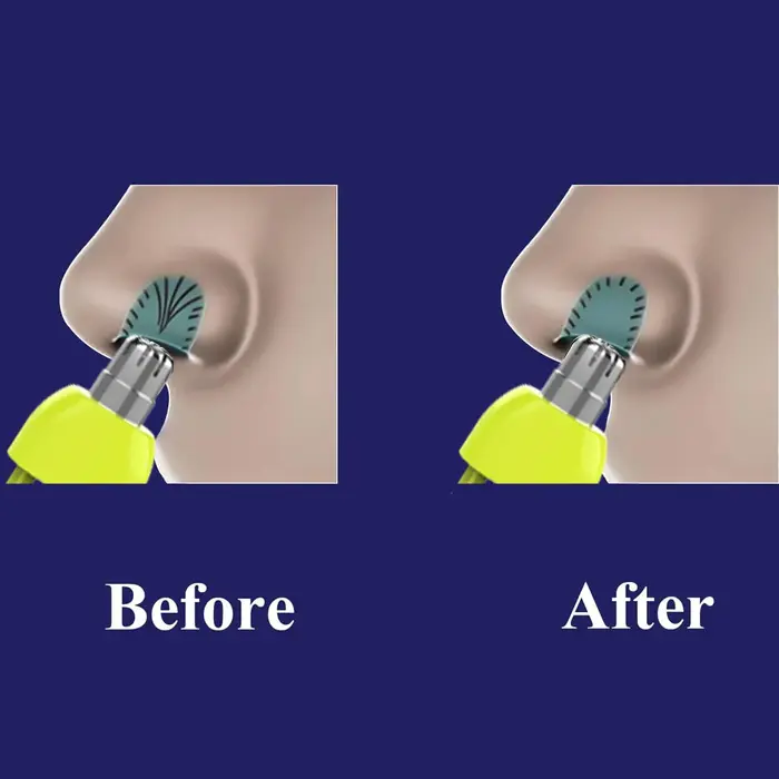 Têtes de rechange pour tondeuse à poils de nez Brangdy, pour rasoir Philips OneBlade QP2520 QP2630 QP6520 QP6530, lame à double tranchant lavable
