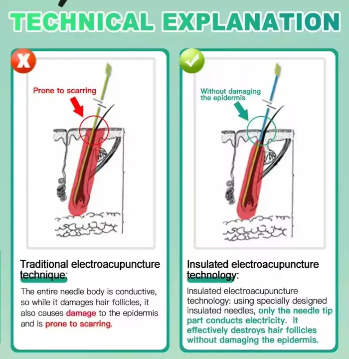 Appareil professionnel d'épilation permanente par électrolyse pour toutes les couleurs de poils