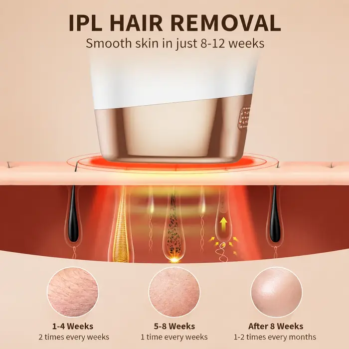 Appareil d'épilation IPL pour femmes et hommes