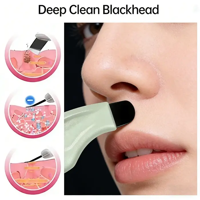 Outil de nettoyage en profondeur des points noirs et blancs pour le nez et le visage