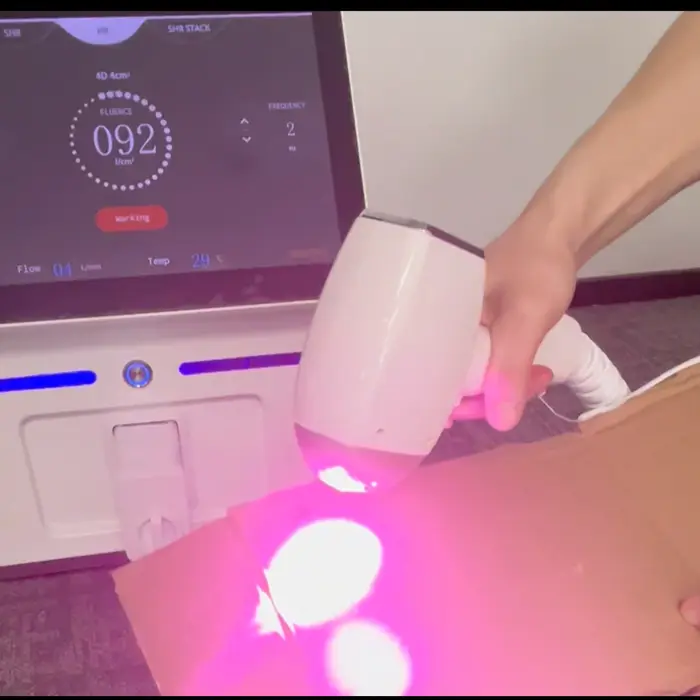Appareil professionnel d'épilation au laser à diode – 808 nm
