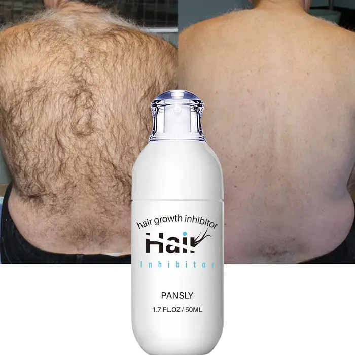 Spray d'épilation 100ML