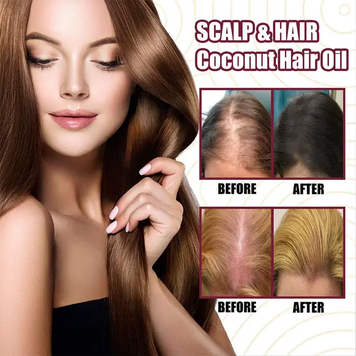 Spray d'huile essentielle d'oignon rouge pour les soins capillaires