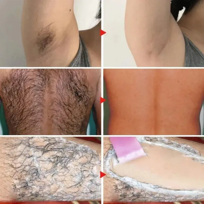 Crème dépilatoire permanente pour zones intimes, crème dépilatoire indolore, inhibiteur de croissance des poils, soins corporels pour femmes et hommes