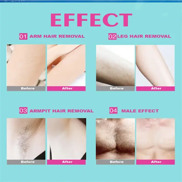 Lot de 10 bandes de cire dépilatoires en non-tissé pour le visage