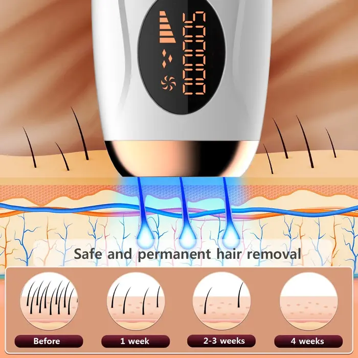 Épilateur laser IPL portable 999999 Flashes - Épilation indolore et permanente pour le corps et la ligne bikini des