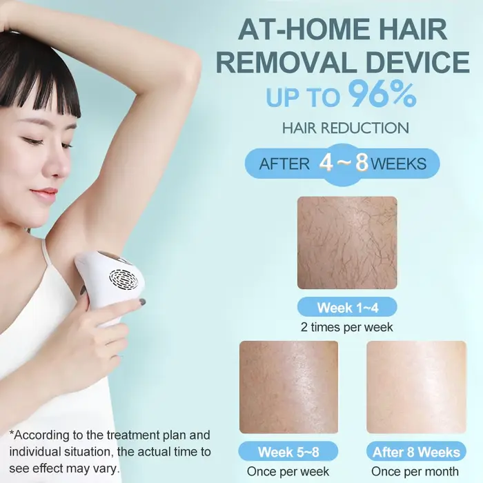 Combiné d'épilation au laser portable Vancostar 900000 Flashes Épilateur permanent indolore pour femme à la maison