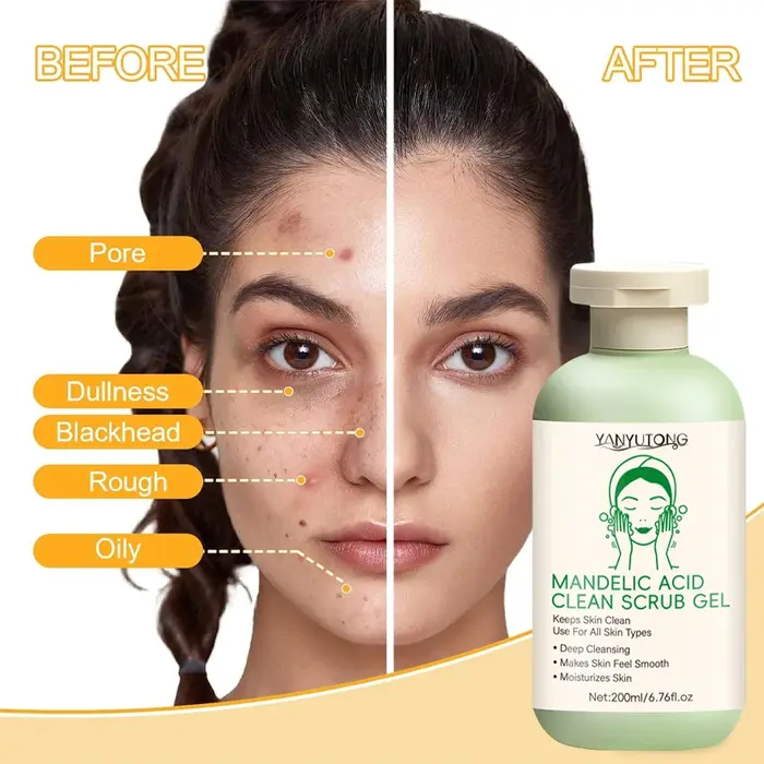 Gel exfoliant pour le visage