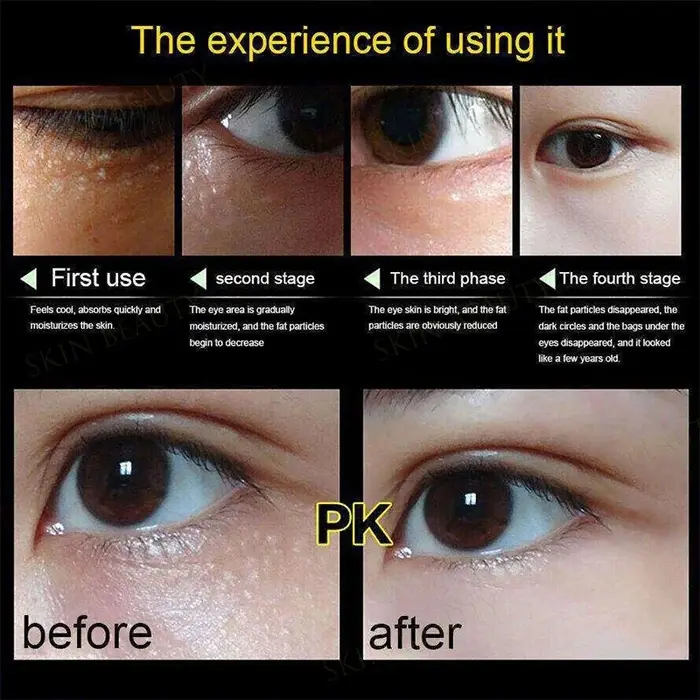 Crème pour les yeux anti-poches
