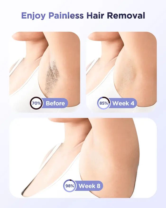 Appareil d'épilation IPL à 9 niveaux avec refroidissement par glace, épilateur laser à domicile pour femmes, appareil de beauté pour une peau lisse et indolore