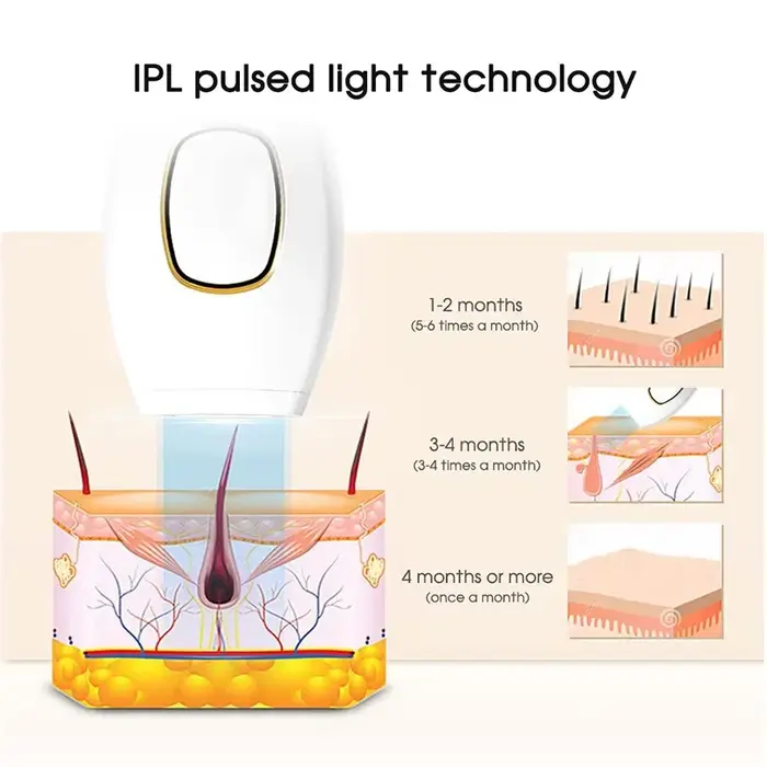 Épilateur laser IPL, épilateur à flash rapide, épilateur permanent indolore, traitement corporel pour femmes